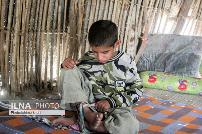 با محرومان؛ درد معلولیت با چاشنی فقر و دورافتادگی