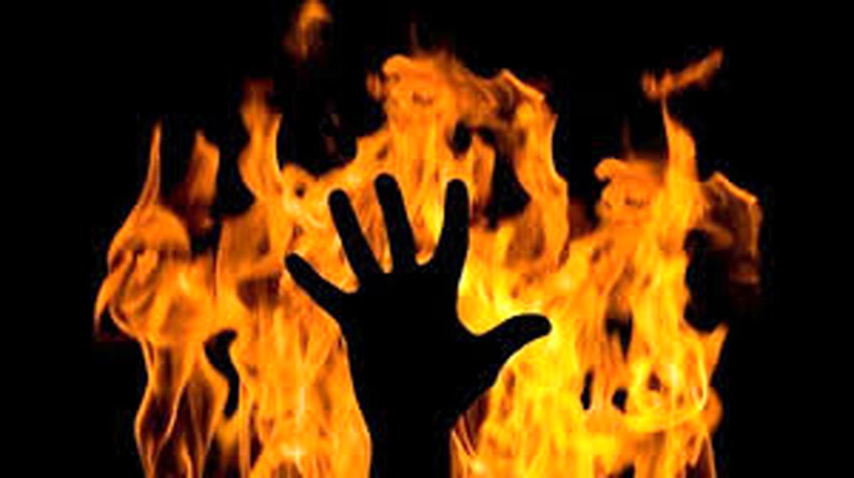سوختگی 80 درصدی دختر 17 ساله دیشموکی/ بخشدار دیشموک: خودسوزی را تایید نمی‌کنم