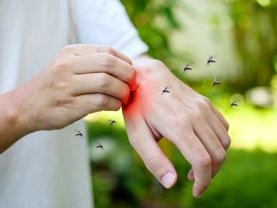 موثرترین راه‌ دفع پشه‌ها
