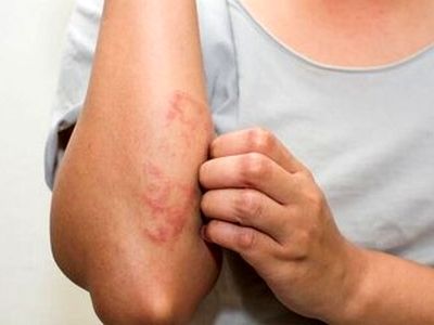 بهبود بیماری‌های پوستی با مصرف این نوع سرکه