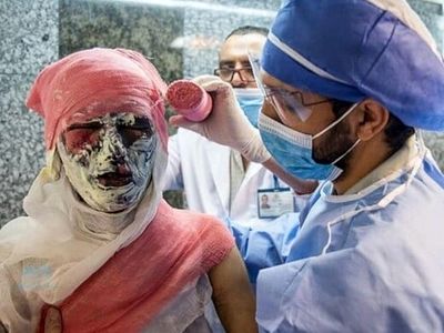 19 مصدوم تلفات چهارشنبه سوری کرمانشاه تا کنون