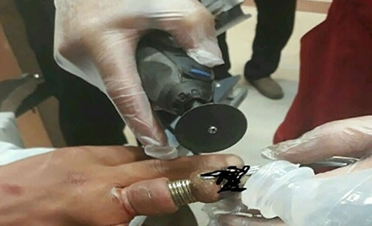 دردسر 2 حلقه انگشتر برای مرد ۴۰ ساله 