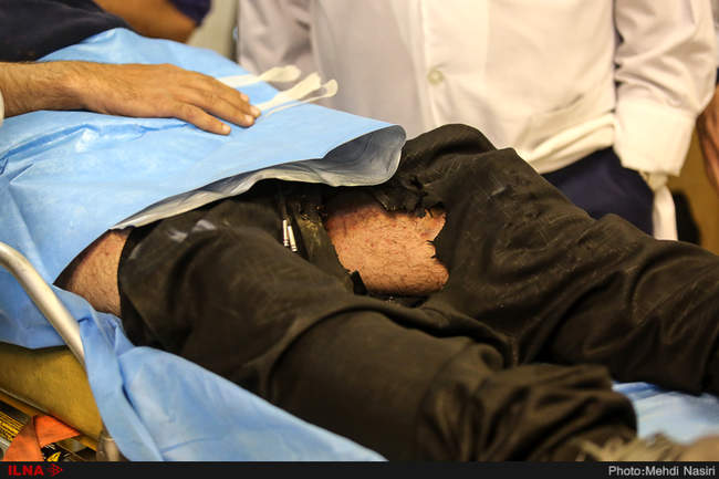 مصدومان مراسم چهارشنبه آخر سال 1396