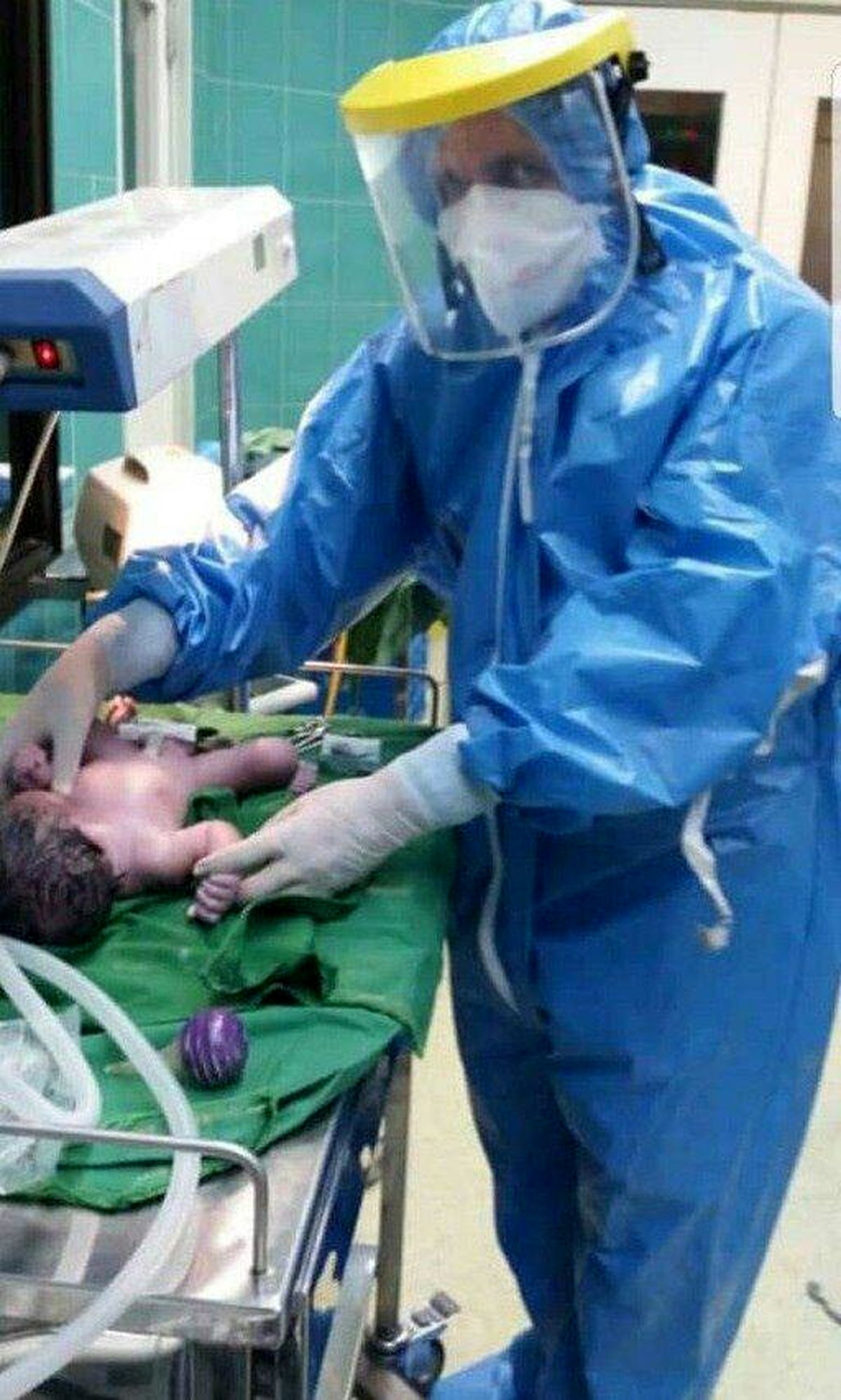 تولد "محمد" از مادر مشکوک به کرونا در سمنان پیام آور امید بود 