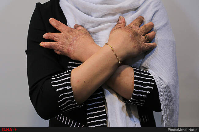 موج آرزوهای سوخته بر صورت دخترکان شین آبادی