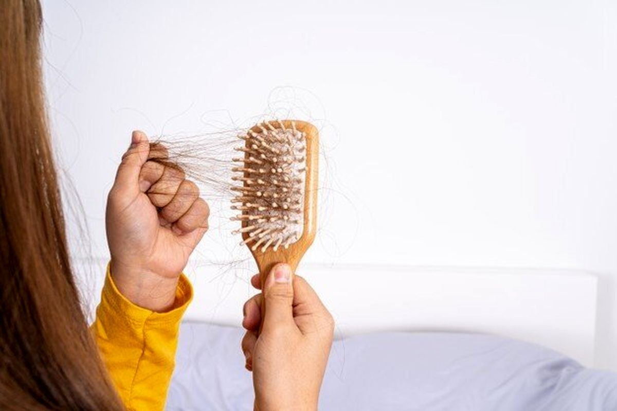 این غذاها را نخورید تا ریزش مو نگیرید