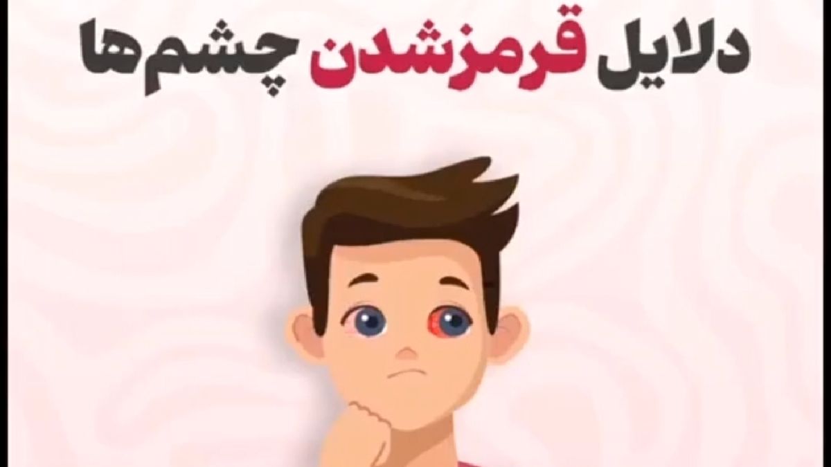چه زمانی باید برای قرمز شدن چشم‌ها به پزشک مراجعه کرد؟ + فیلم