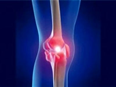 راهکار جدید تسکین درد آرتروز 