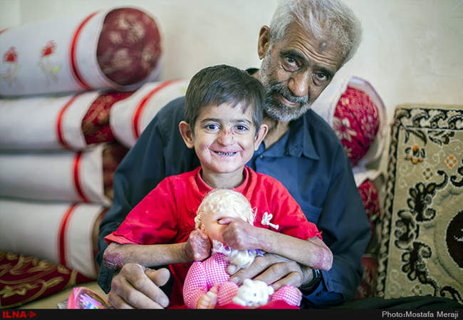 EB، مرگ خاموش کودکان جنوب کرمان