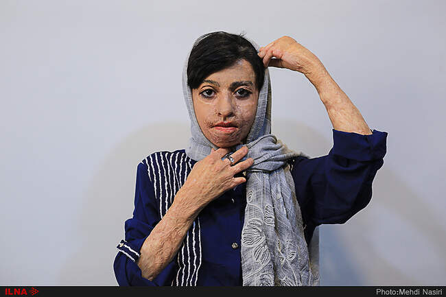 موج آرزوهای سوخته بر صورت دخترکان شین آبادی