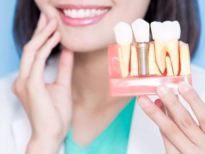 هزینه ایمپلنت دندان اصفهان: راهنمای جامع و تخصصی