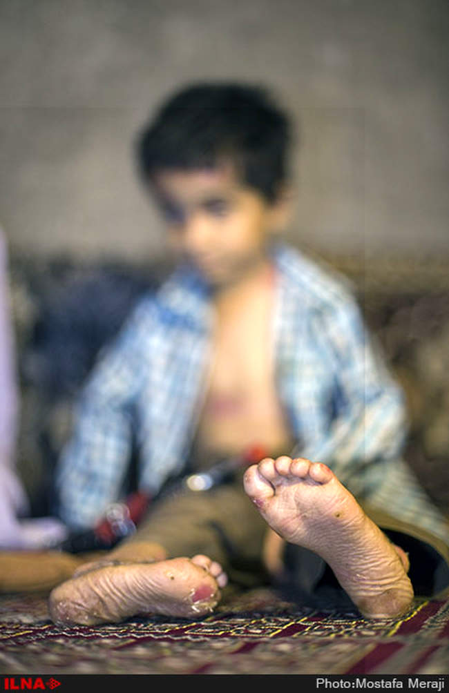 EB، مرگ خاموش کودکان جنوب کرمان