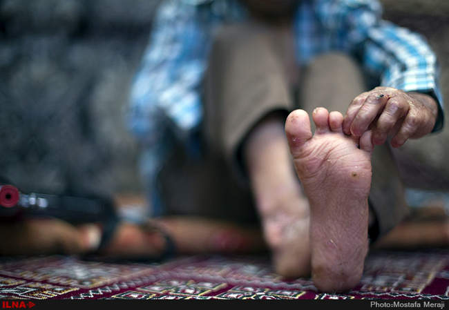 EB، مرگ خاموش کودکان جنوب کرمان