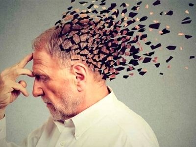نشانه اولیه بیماری آلزایمر چیست؟ 