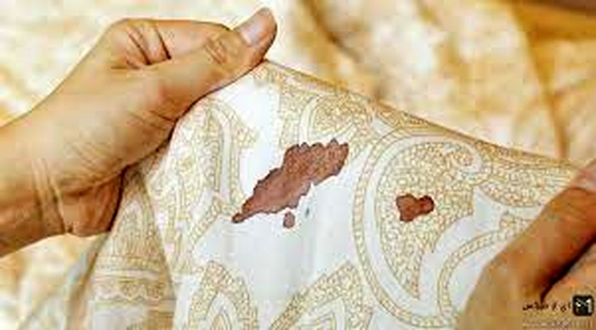 پاک کردن لکه خون خشک شده روی لوازم مختلف