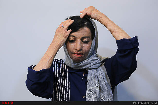 موج آرزوهای سوخته بر صورت دخترکان شین آبادی